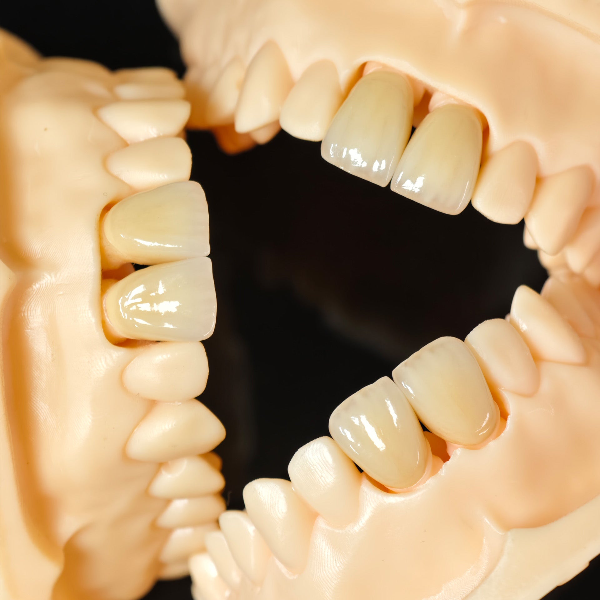 PFZ Crowns Aesthetic Shape Natural Shade Dental Crown