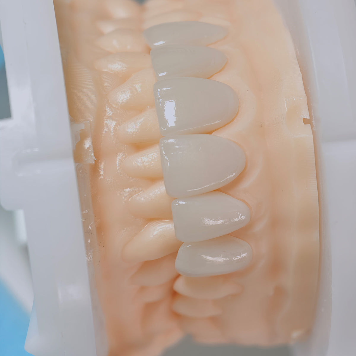 PFZ Porcelain Fused Zirconia Aidite Zirconia