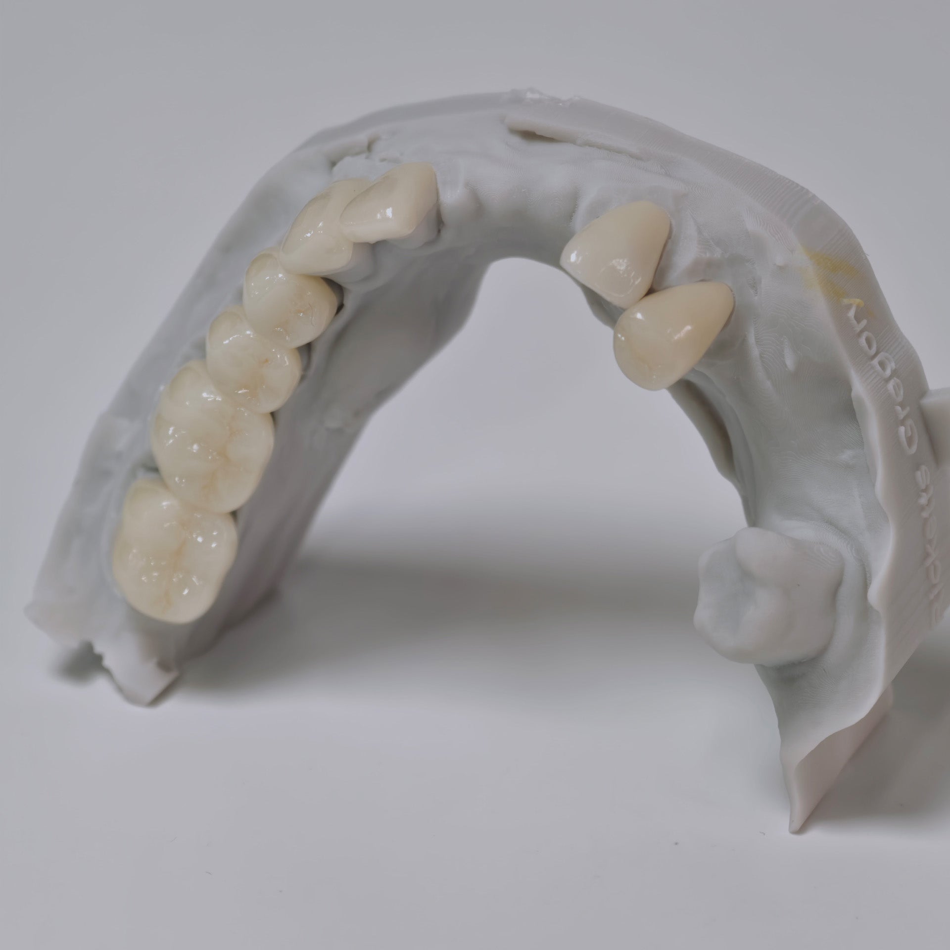PFZ Porcelain Fused Zirconia Aidite Zirconia