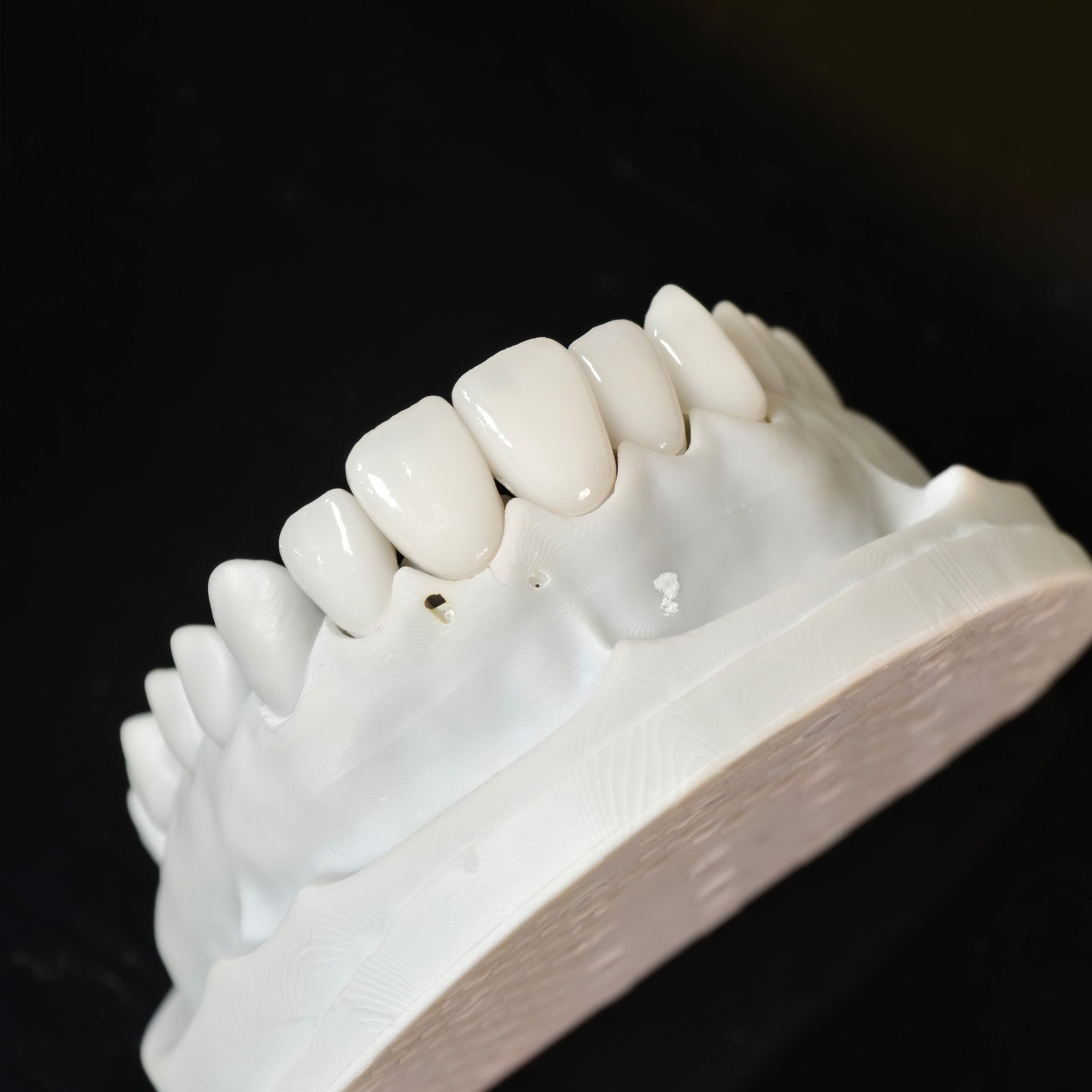 PFZ Porcelain Fused Zirconia Aidite Zirconia