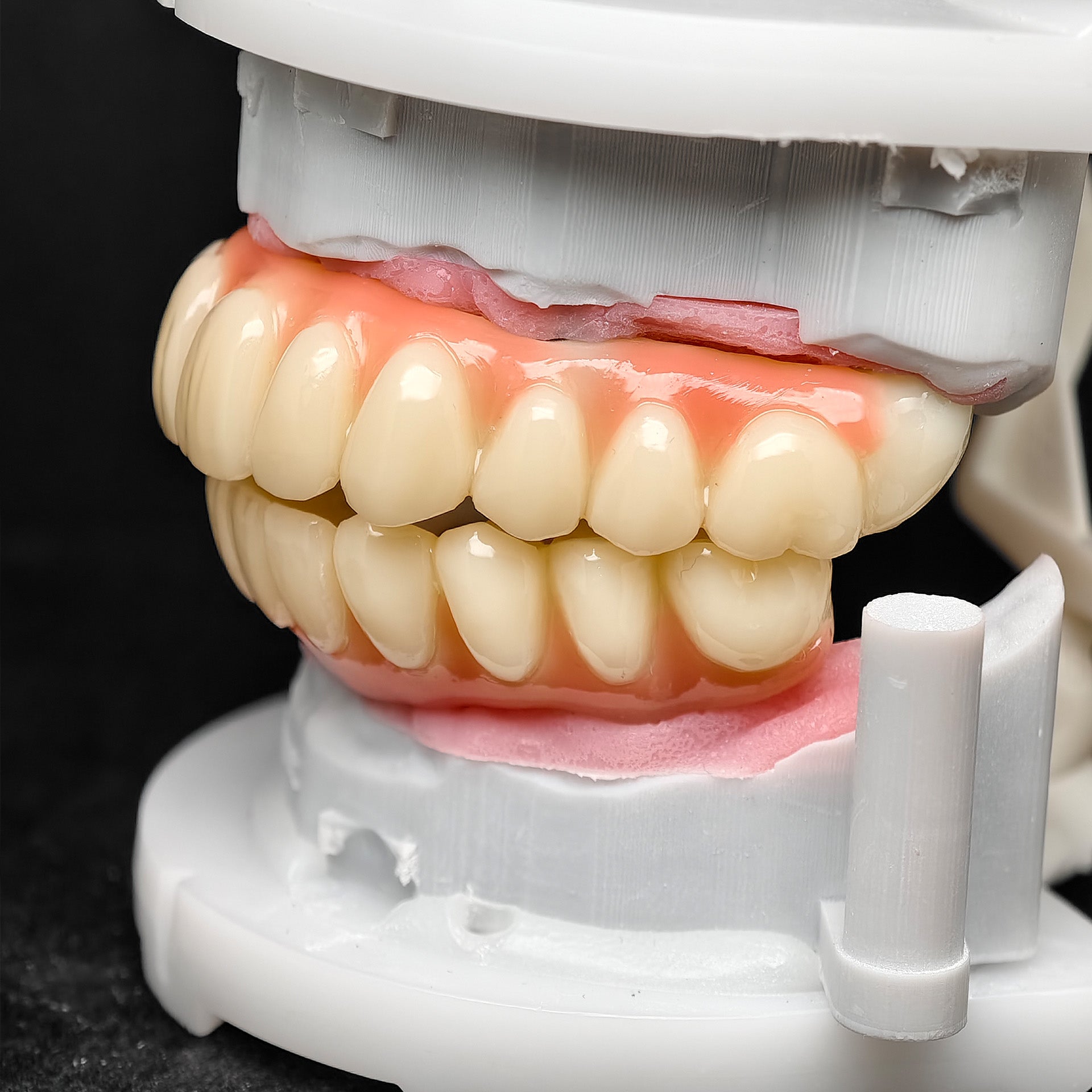 PMMA Bridge With Ti-Base Screw Retained Trying For Full Arch Restoration