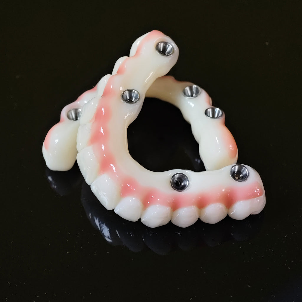 PMMA Bridge With Ti-Base Screw Retained Trying For Full Arch Restoration