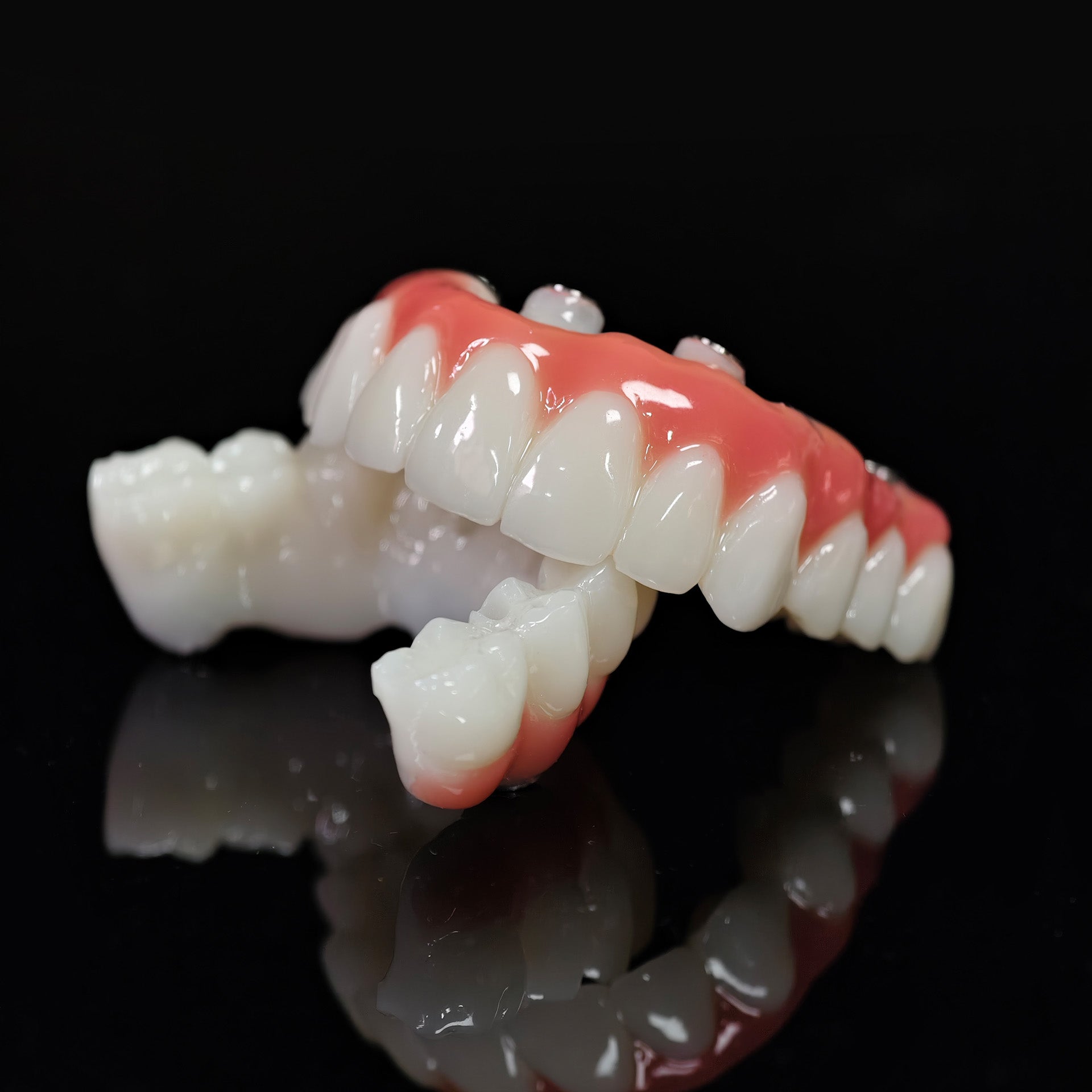 PMMA Bridge With Ti-Base Screw Retained Trying For Full Arch Restoration