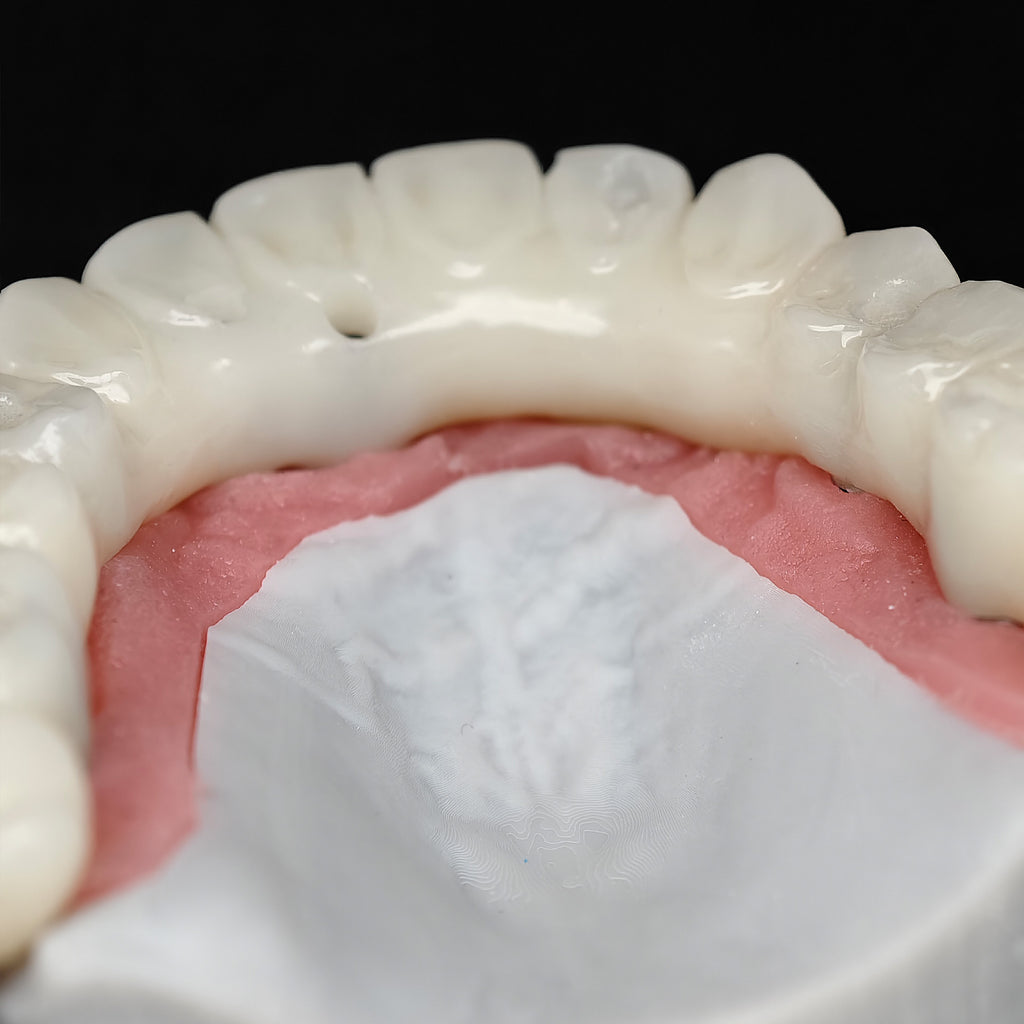 PMMA Bridge With Ti-Base Screw Retained Trying For Full Arch Restoration