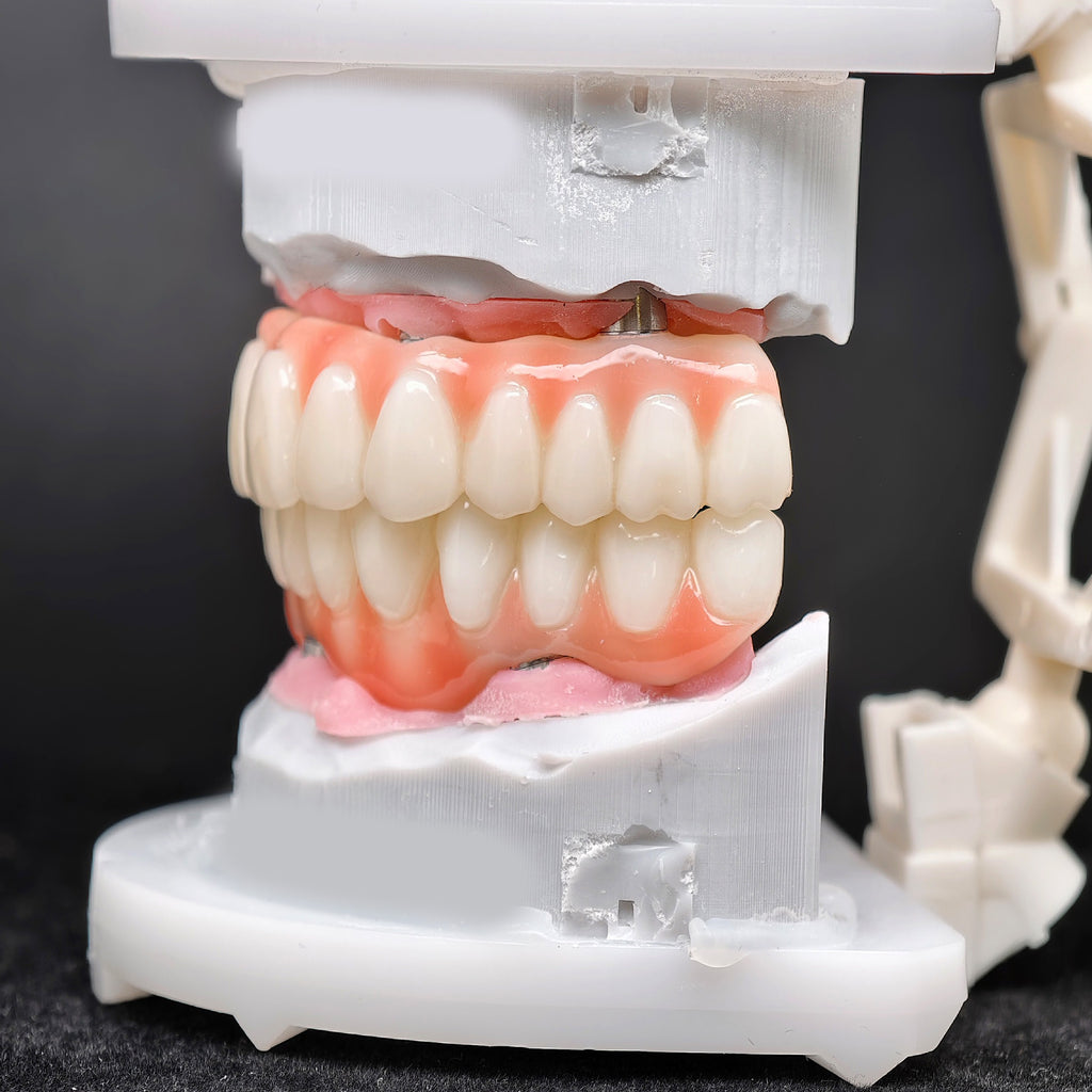 PMMA Bridge With Ti-Base Screw Retained Trying For Full Arch Restoration