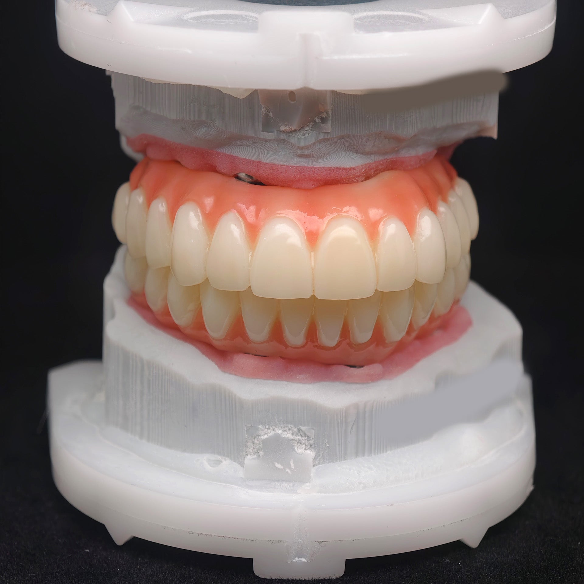 PMMA Bridge With Ti-Base Screw Retained Trying For Full Arch Restoration