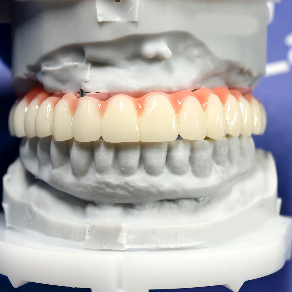 PMMA Bridge With Ti-Base Screw Retained Trying For Full Arch Restoration