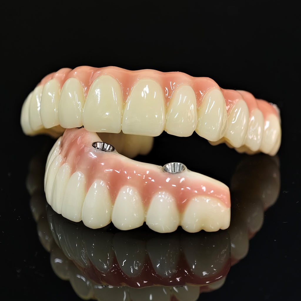 PMMA Bridge With Ti-Base Screw Retained Trying For Full Arch Restoration