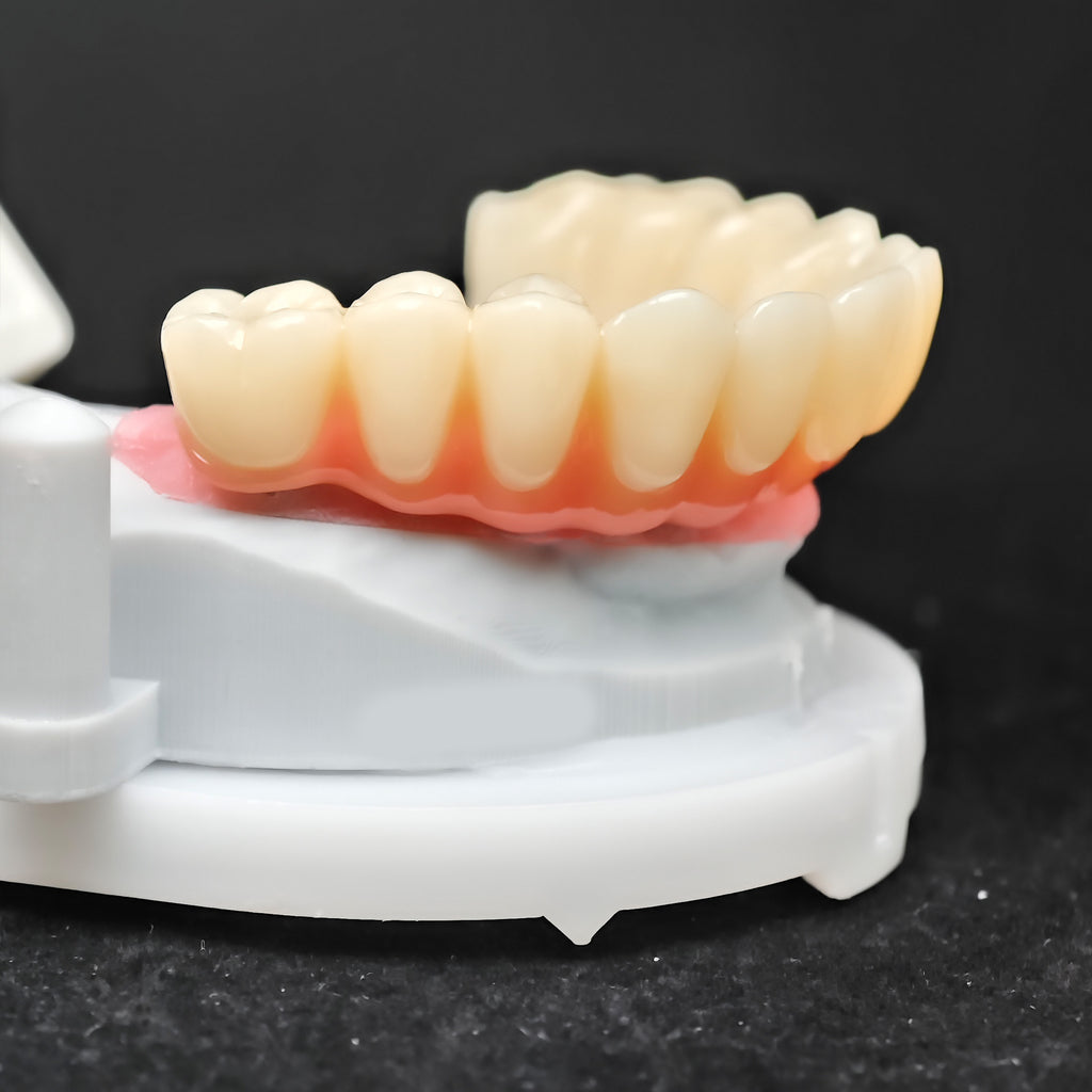 PMMA Bridge With Ti-Base Screw Retained Trying For Full Arch Restoration