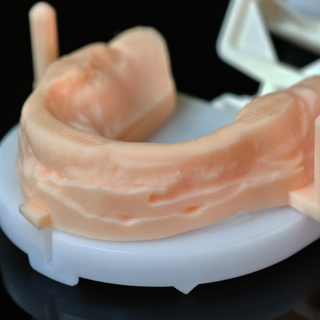 PMMA Bridge With Open Shell Preparing For Full Arch Dental Implants