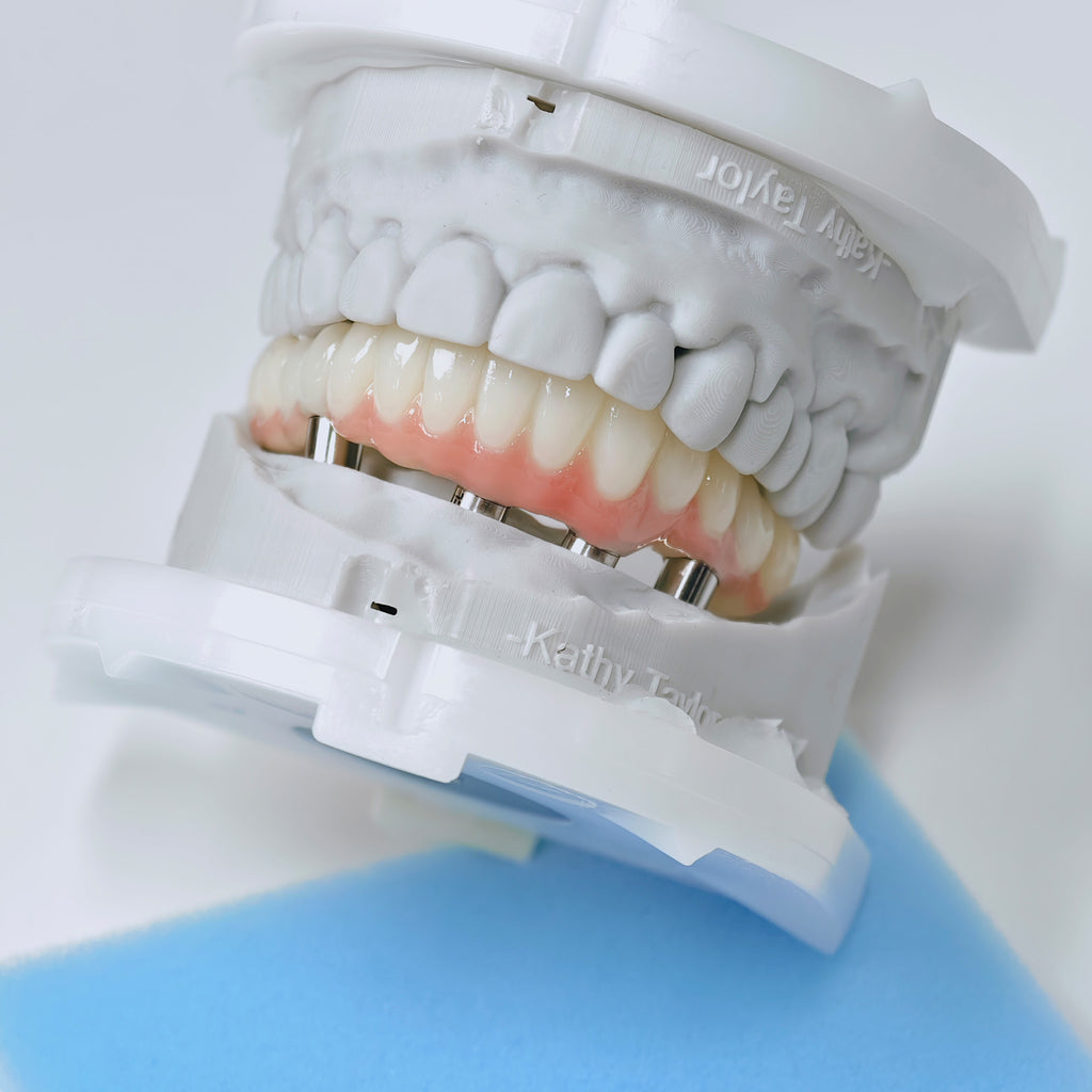 PMMA Bridge With Screw Retained
