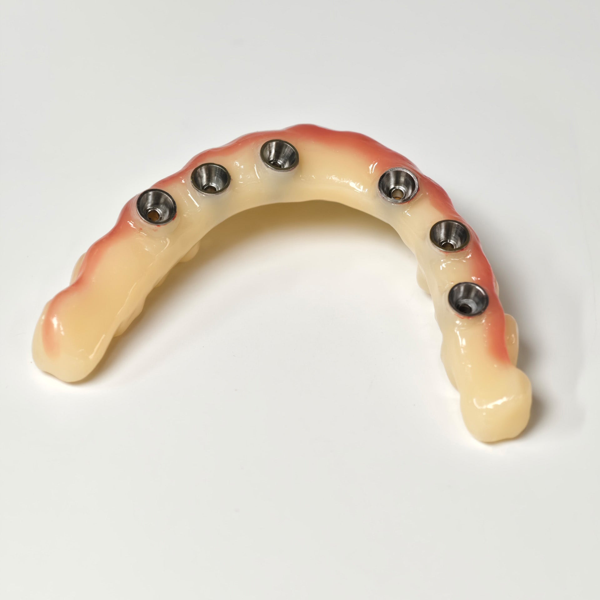 PMMA Bridge With Screw Retained