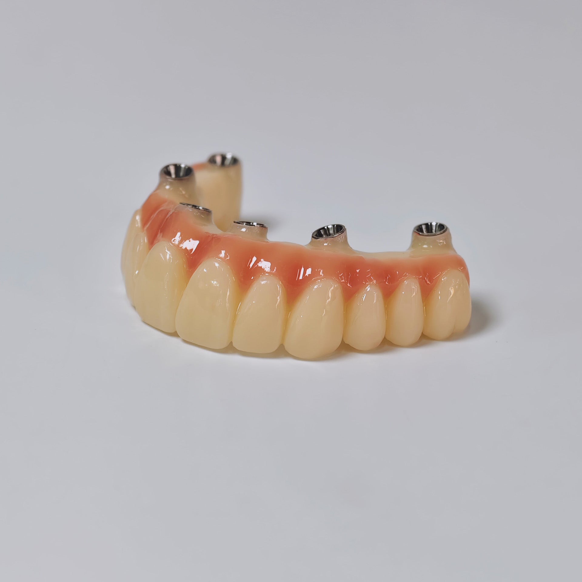PMMA Bridge With Screw Retained