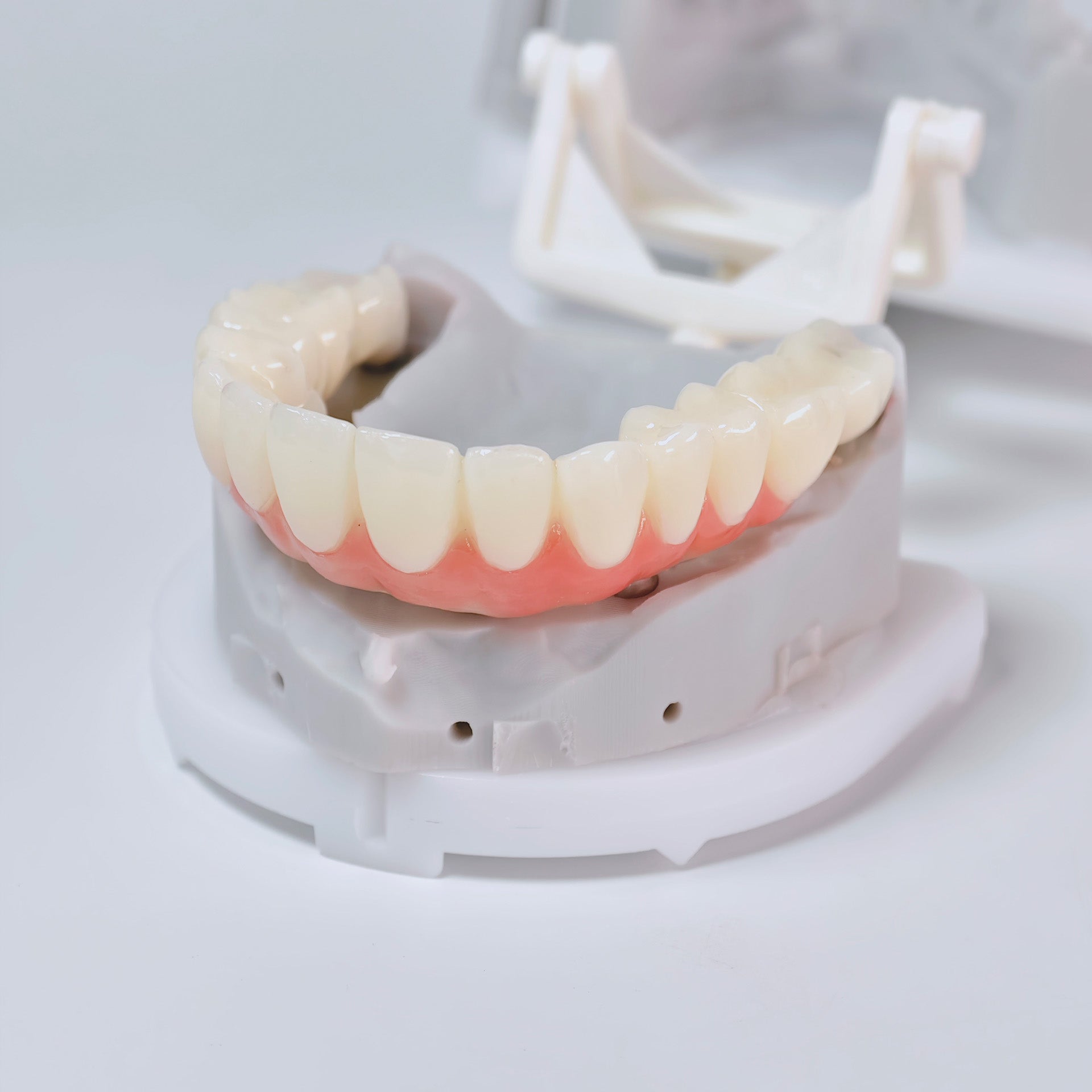 PMMA Bridge With Screw Retained