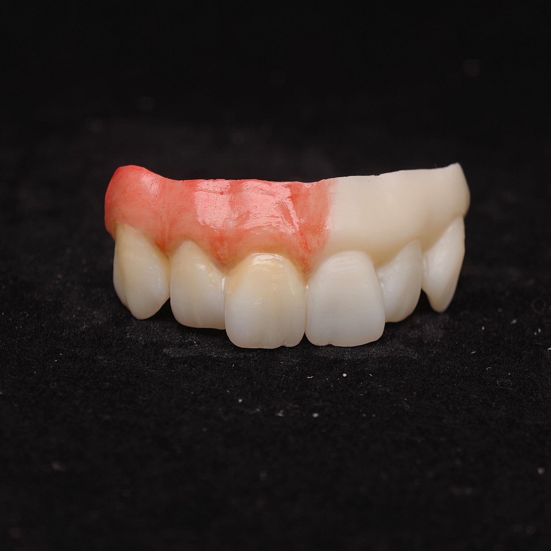 Ti-Bar Pure Titanium Metal Frame With Zirconia Bridge