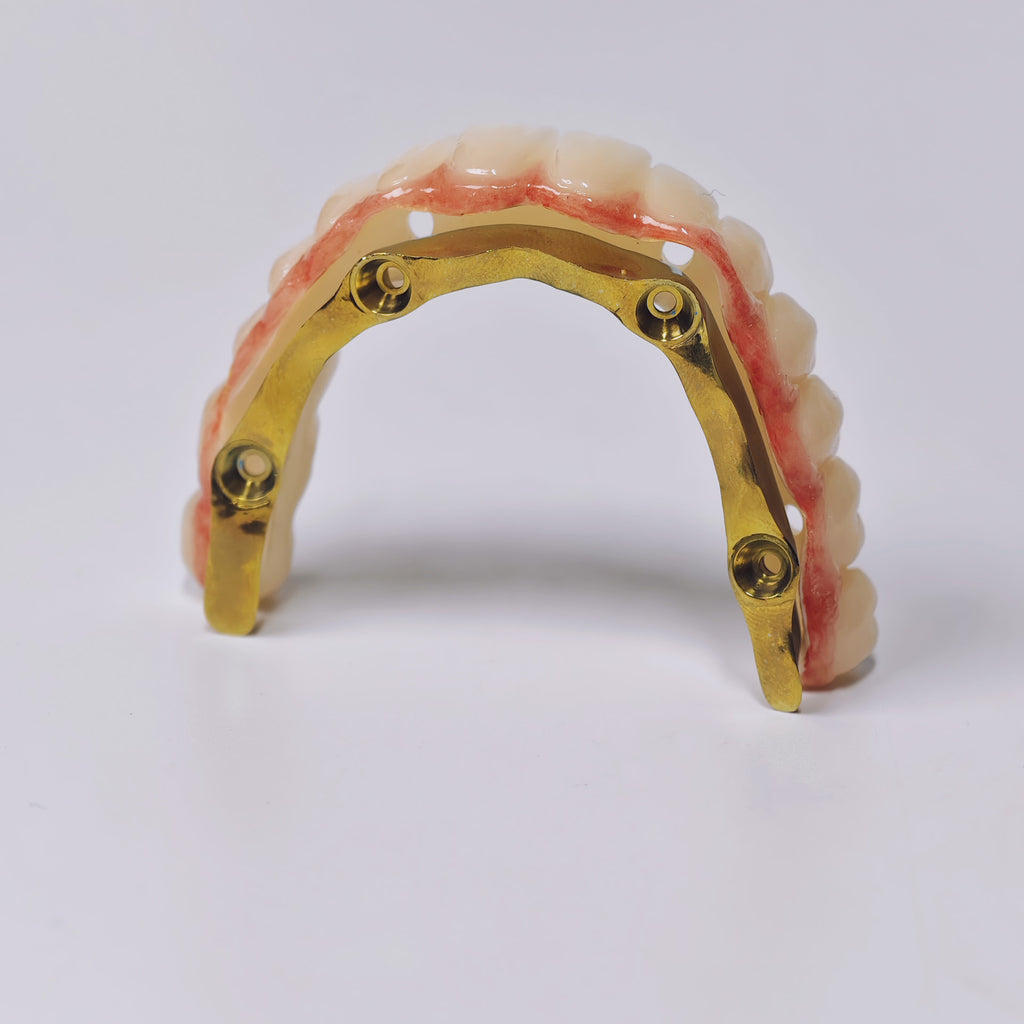 Ti-Bar Titanium Gold-Plated Metal Frame With Zirconia Bridge And Screw Retained
