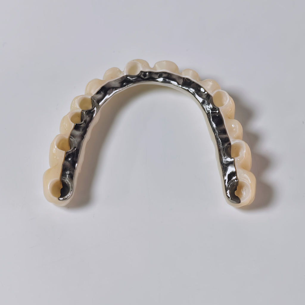 Ti-Bar Titanium Nitride Metal Frame With Zirconia Bridge And Cement Retained