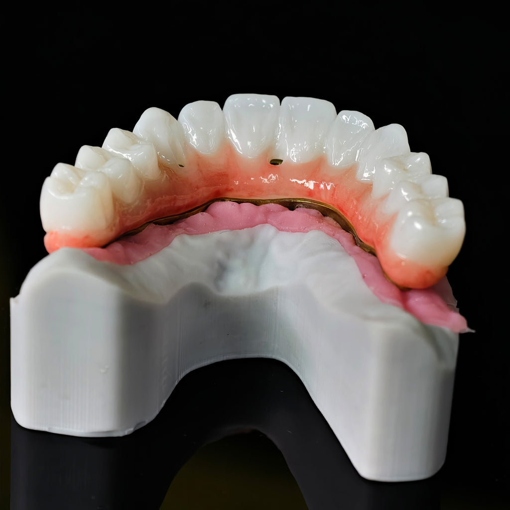 Ti-Bar Titanium Nitride Metal Frame With Zirconia Bridge For Full Arch Restoration
