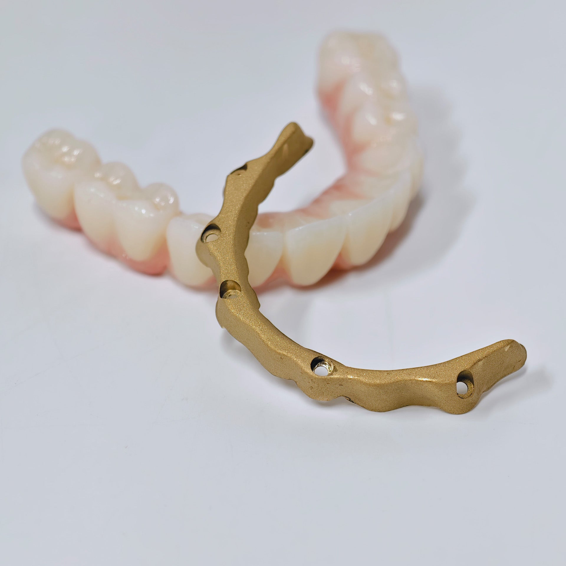 Ti-Bar Titanium Nitride Metal Frame With Zirconia Bridge For Full Arch Restoration