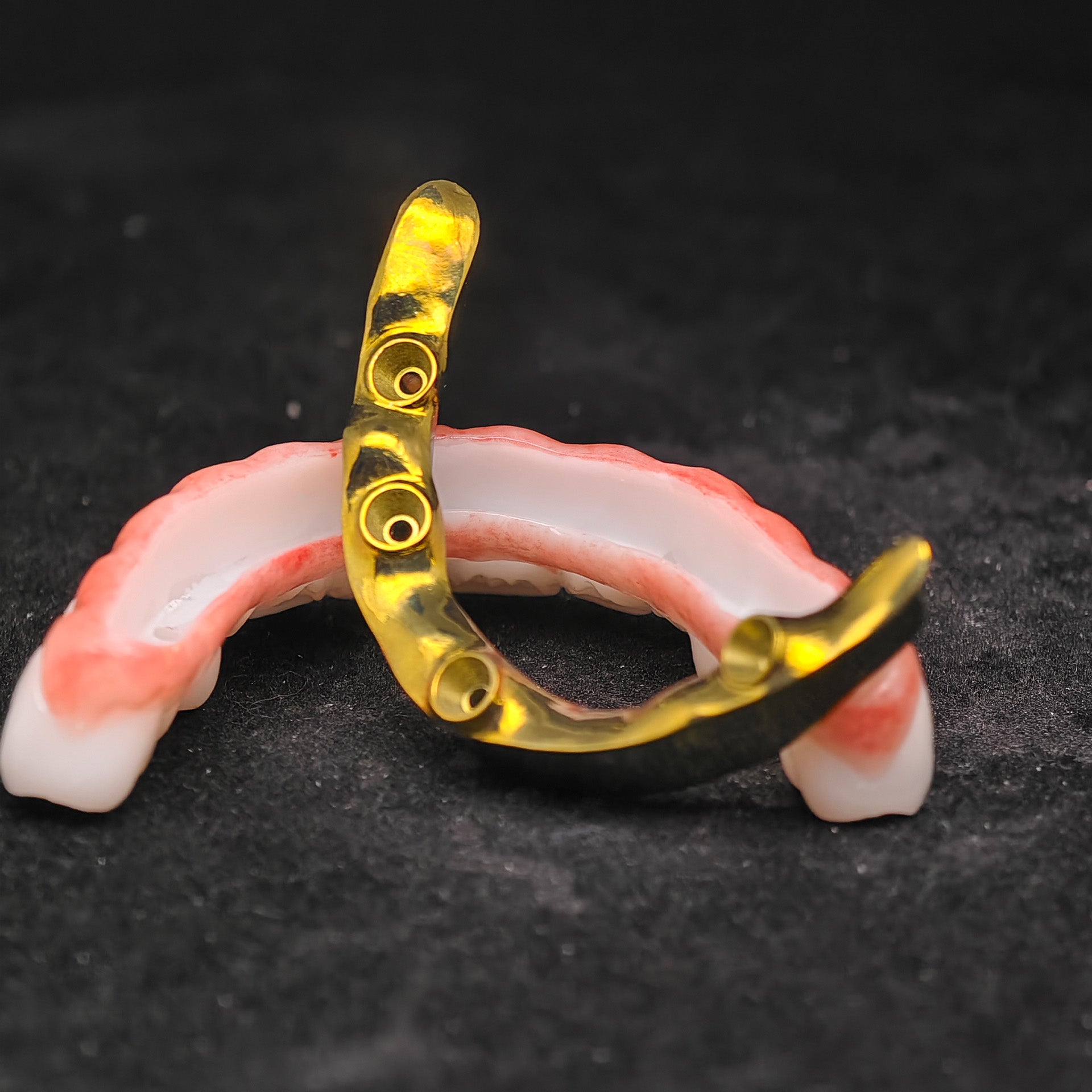 Ti-Bar Titanium Nitride Metal Frame With Zirconia Bridge For Full Arch Restoration