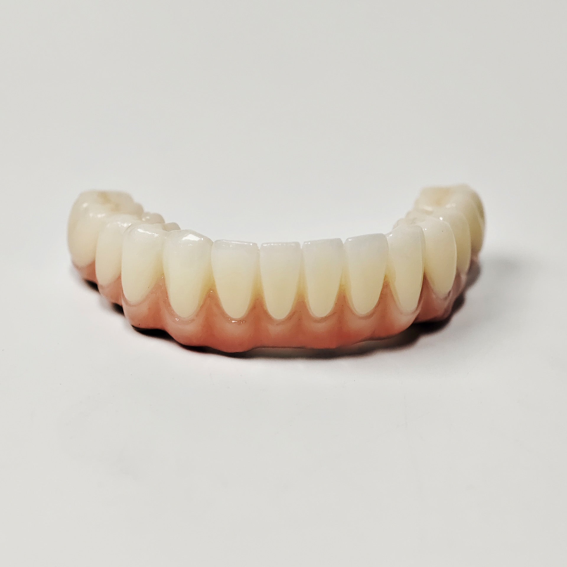 Ti-Bar Titanium Nitride Metal Frame With Zirconia Bridge For Full Arch Restoration