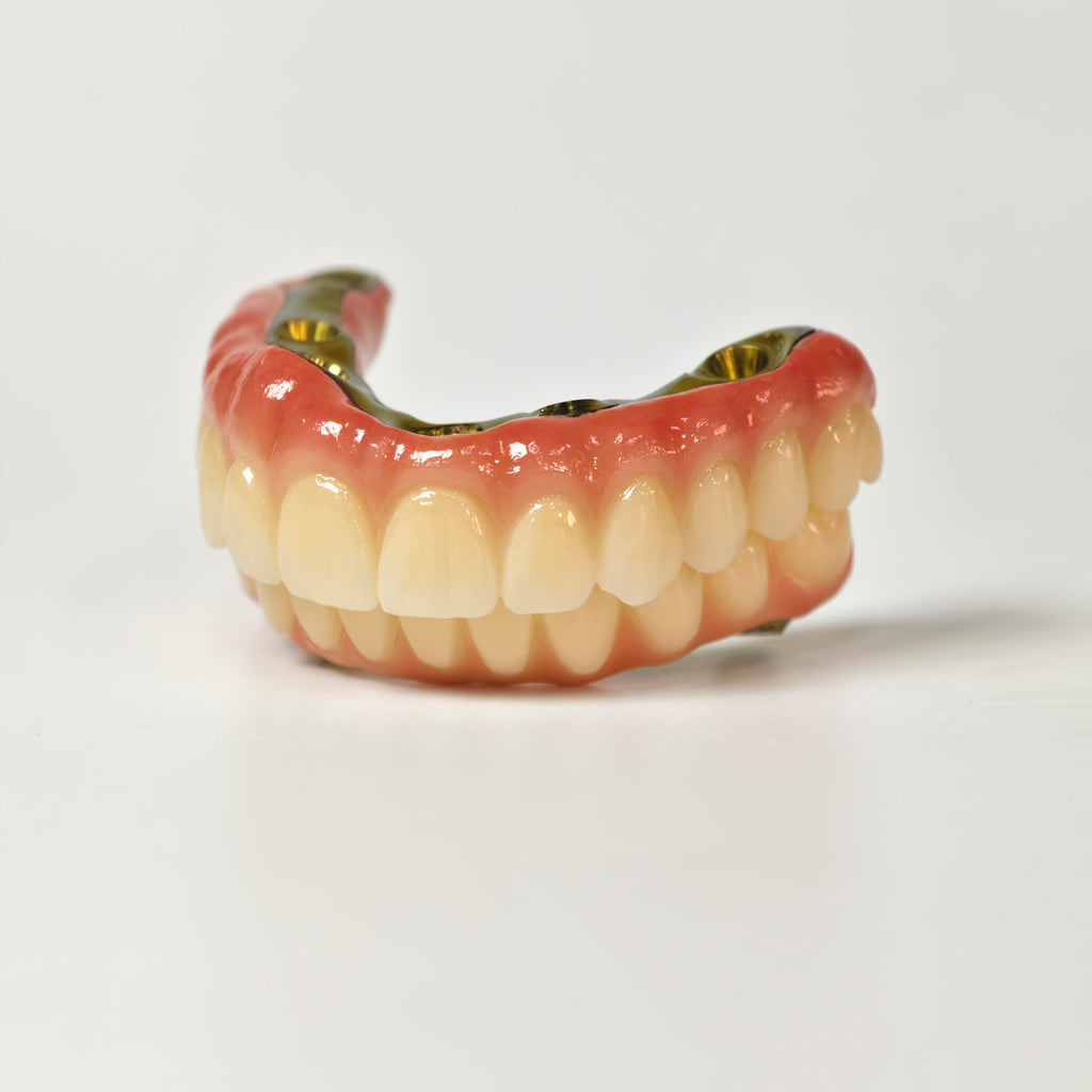 Ti-Bar Titanium Nitride Metal Frame With Zirconia Bridge For Full Arch Restoration