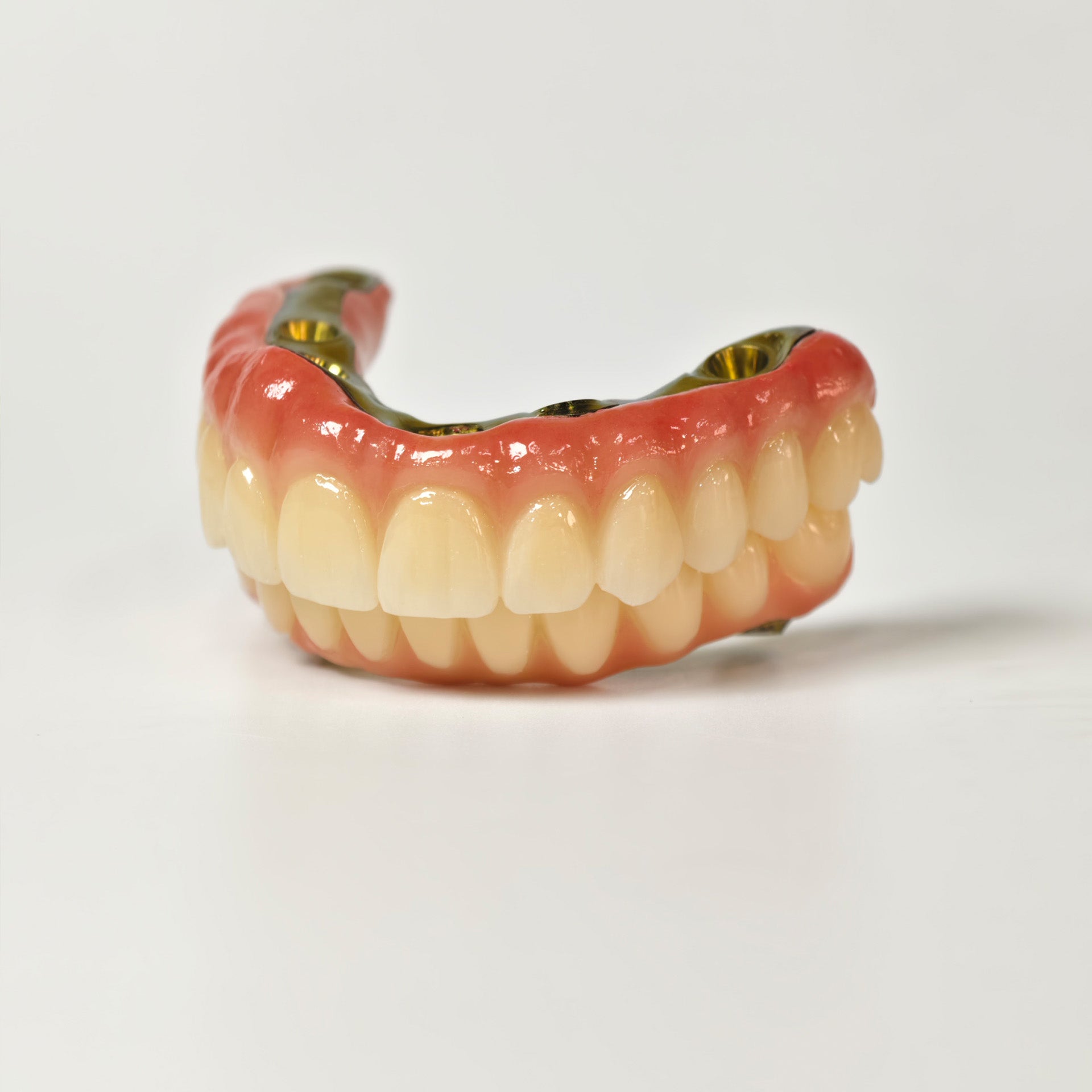 Ti-Bar Titanium Nitride Metal Frame With Zirconia Bridge For Full Arch Restoration