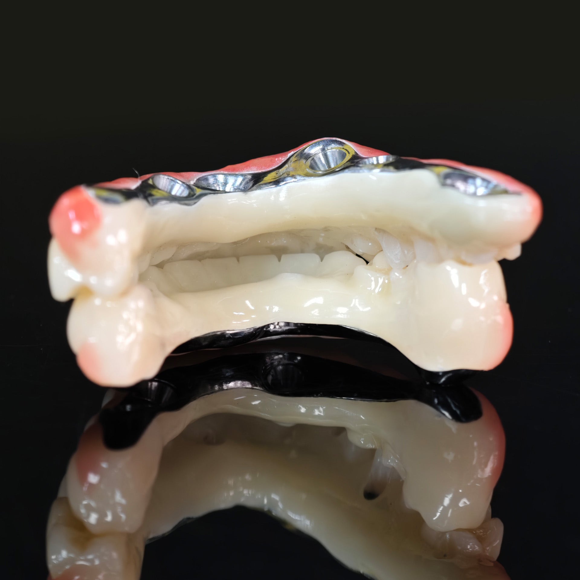 Ti-Bar Titanium Nitride Metal Frame With Zirconia Bridge For Full Arch Restoration
