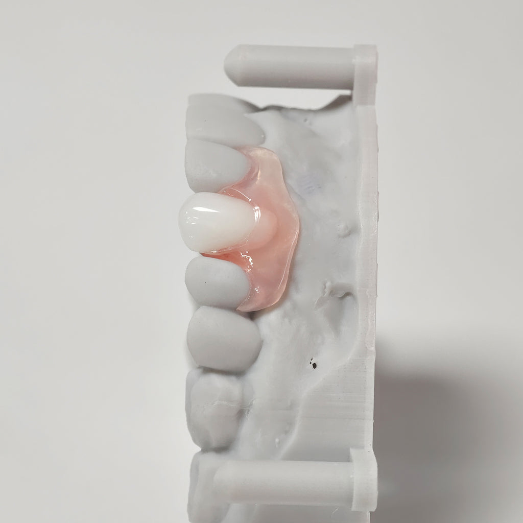 Valplast Denture Beautiful And Elastic Flexible Partial Natural Appearance