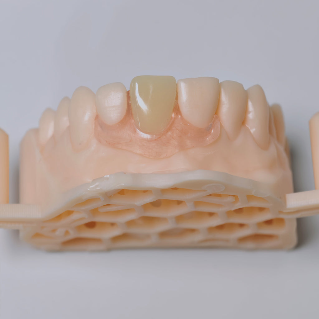 Valplast Denture Beautiful And Elastic Flexible Partial Natural Appearance
