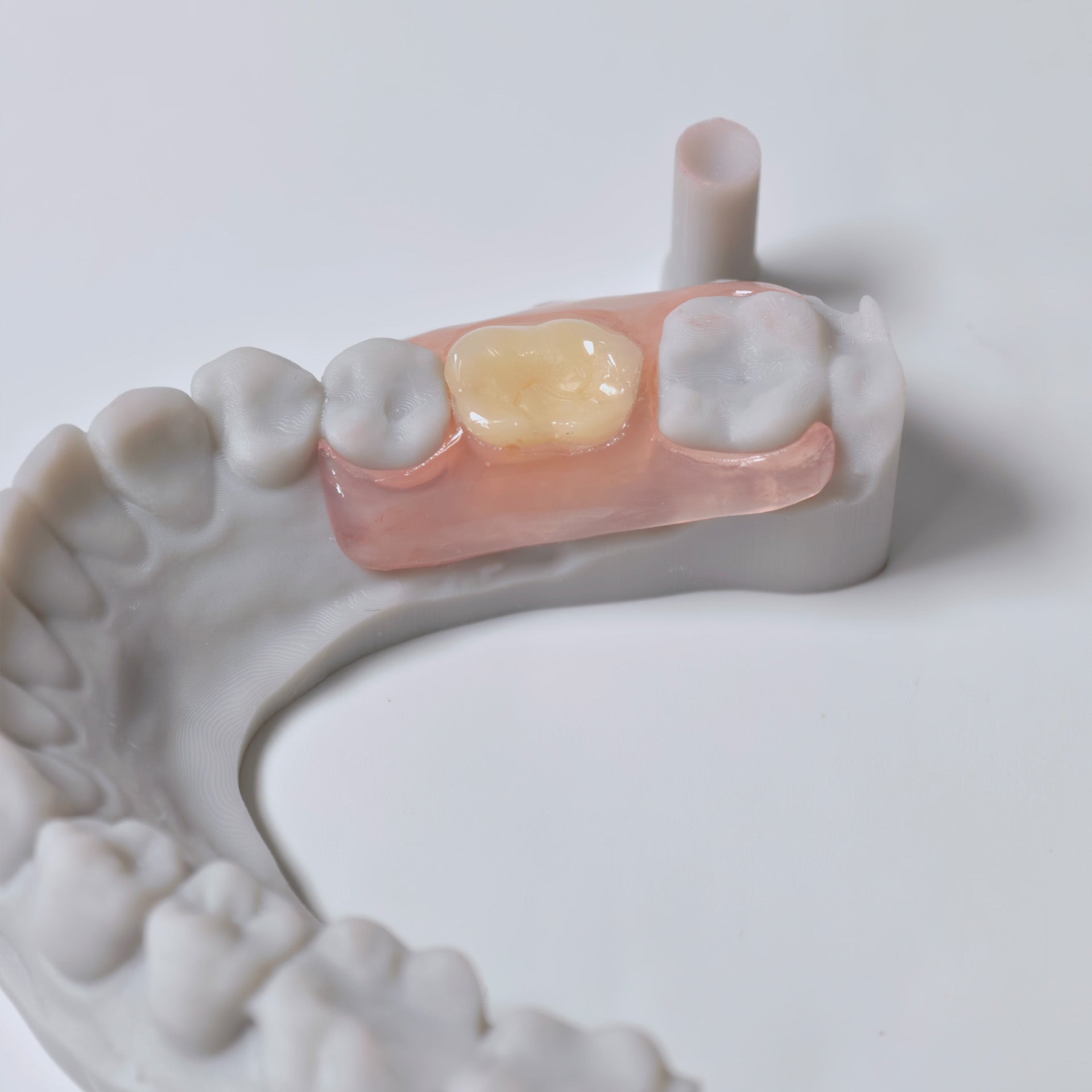 Valplast Denture Beautiful And Elastic Flexible Partial Natural Appearance