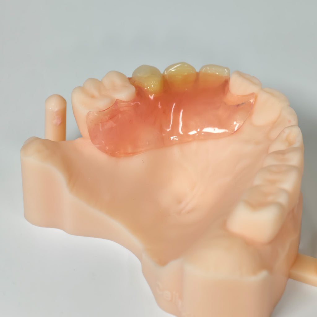 Valplast Denture Beautiful And Elastic Flexible Partial Natural Appearance
