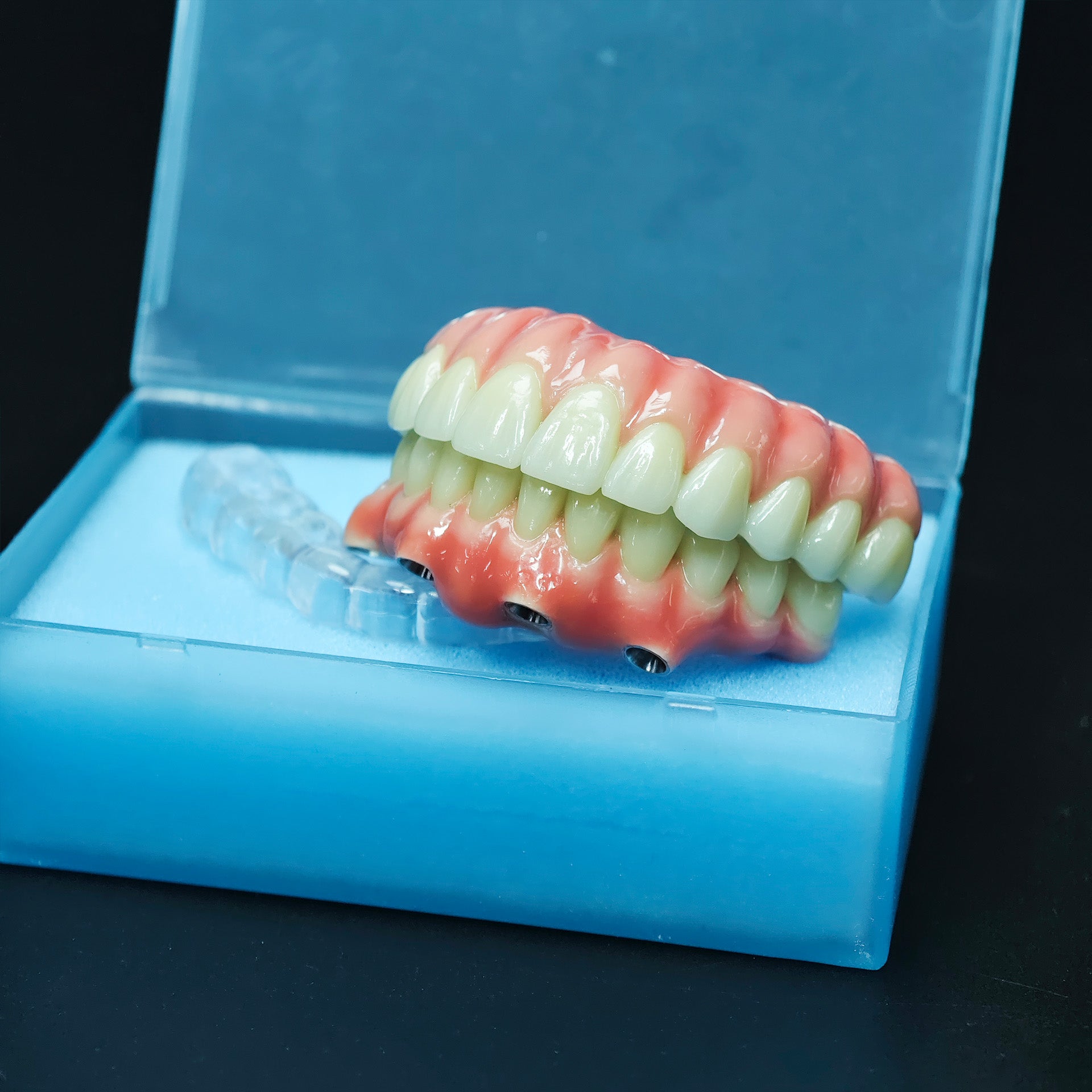 Zirconia-Enamel Hybrid Malo Bridge