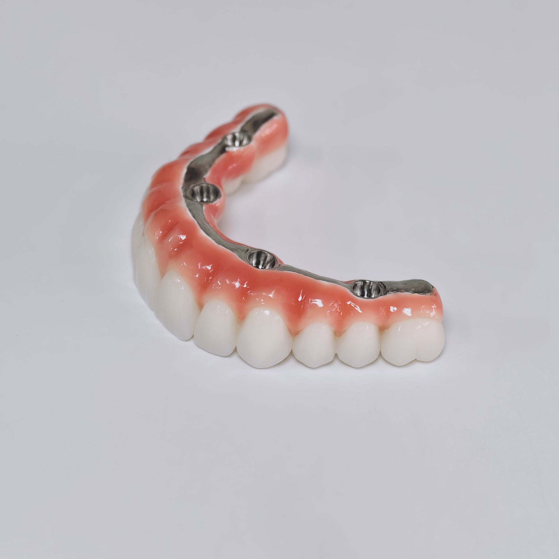 Zirconia-Enamel Hybrid Malo Bridge Aesthetic