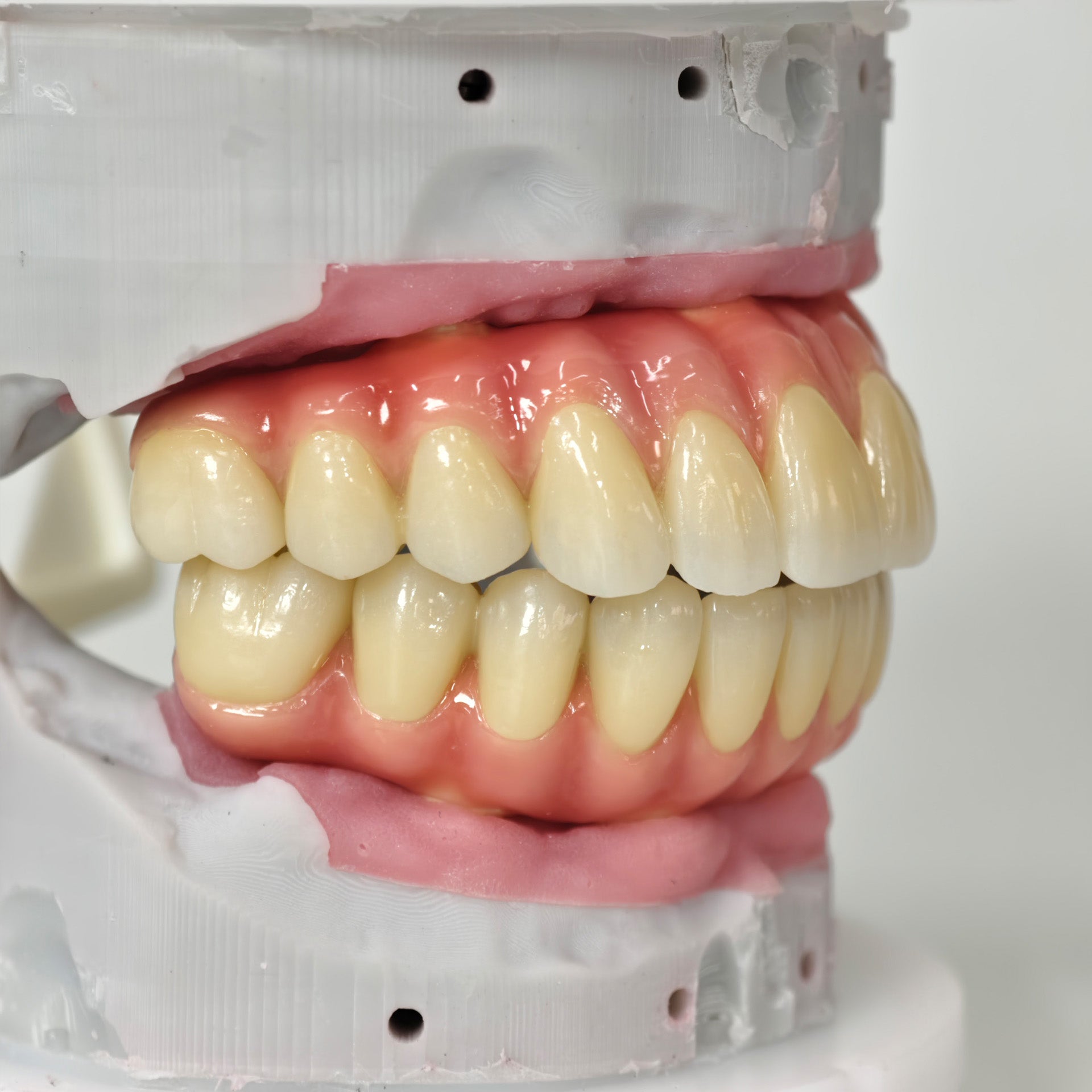 Zirconia-Enamel Hybrid Malo Bridge