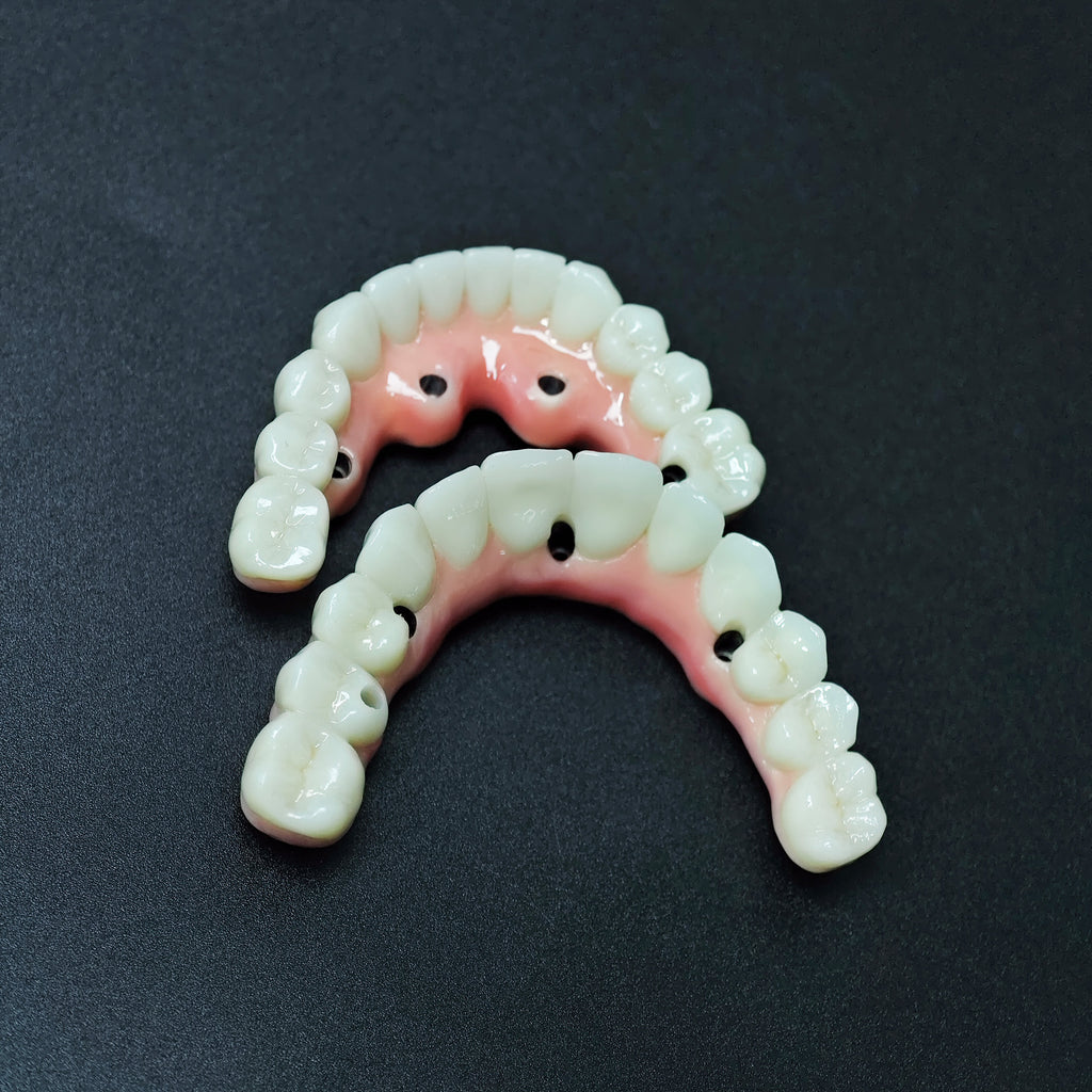 Zirconia-Enamel Hybrid Malo Bridge