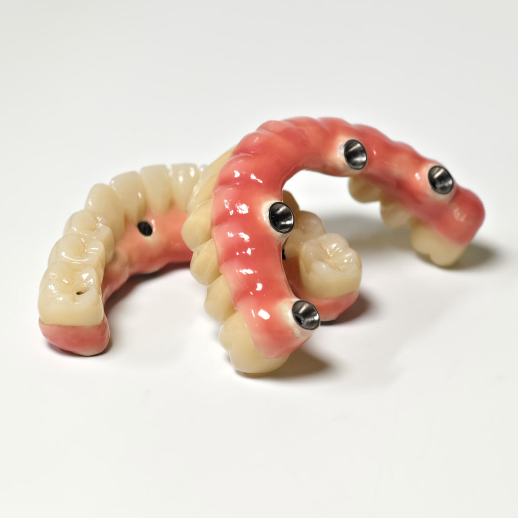 Zirconia-Enamel Hybrid Malo Bridge