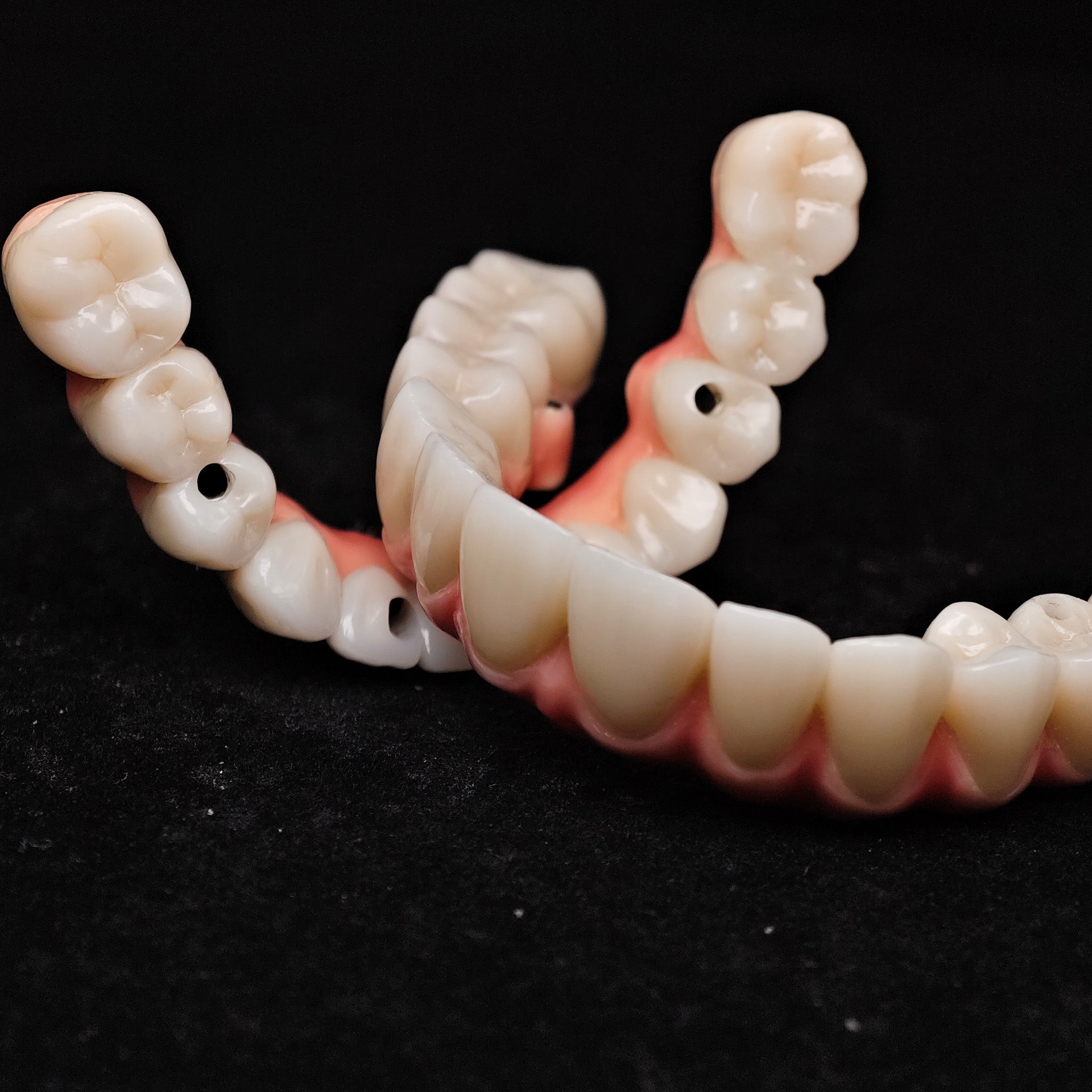 Zirconia-Enamel Hybrid Malo Bridge