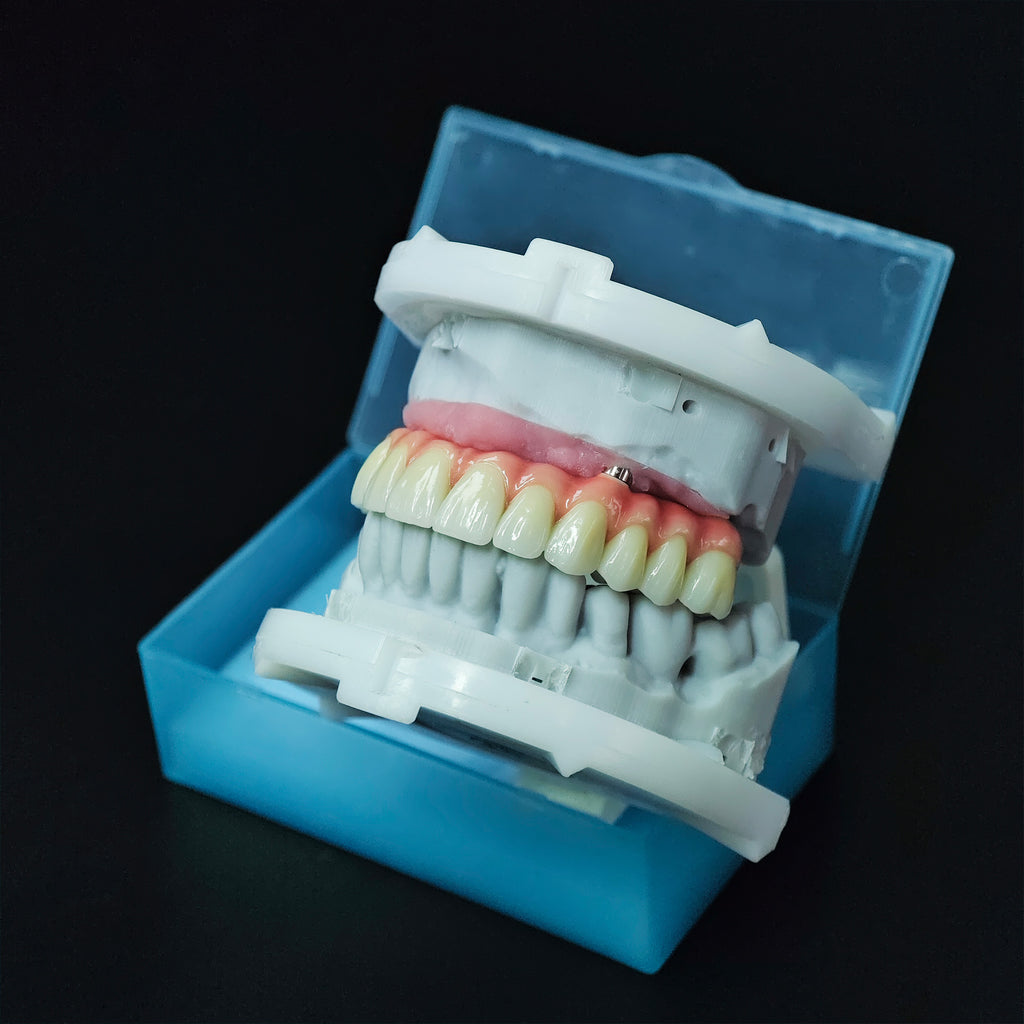 Zirconia-Enamel Hybrid Malo Bridge