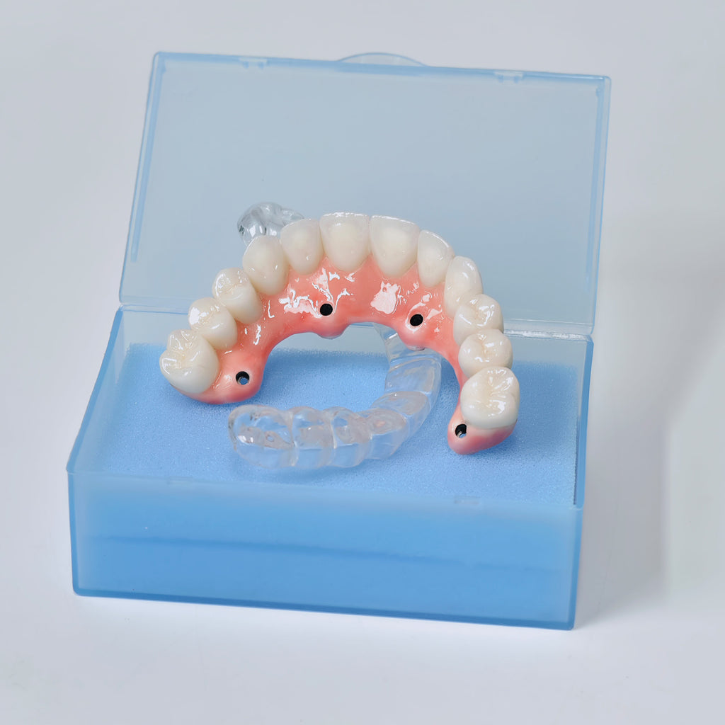 Zirconia-Enamel Hybrid Malo Bridge