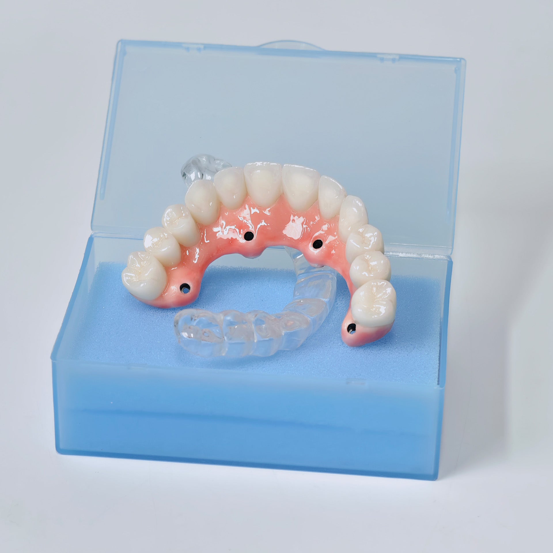 Zirconia-Enamel Hybrid Malo Bridge