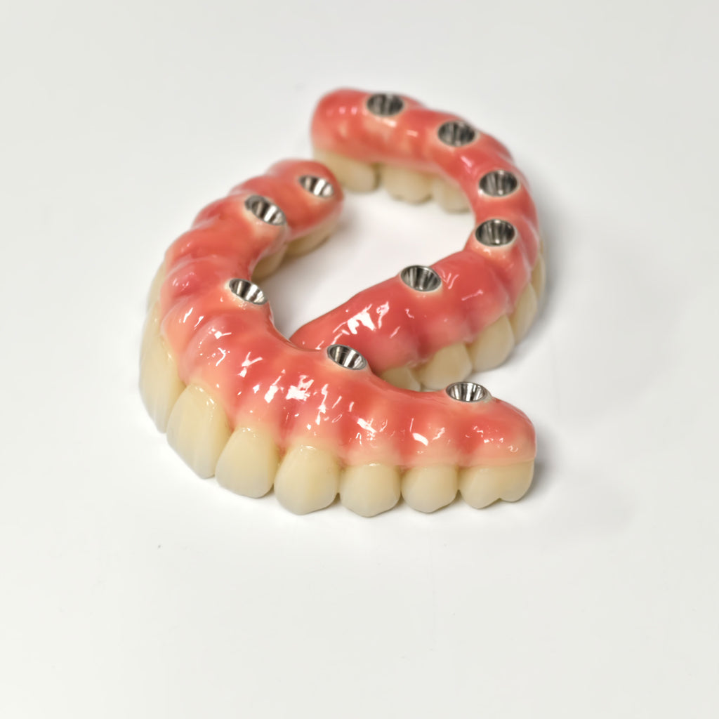 Zirconia-Enamel Hybrid Malo Bridge