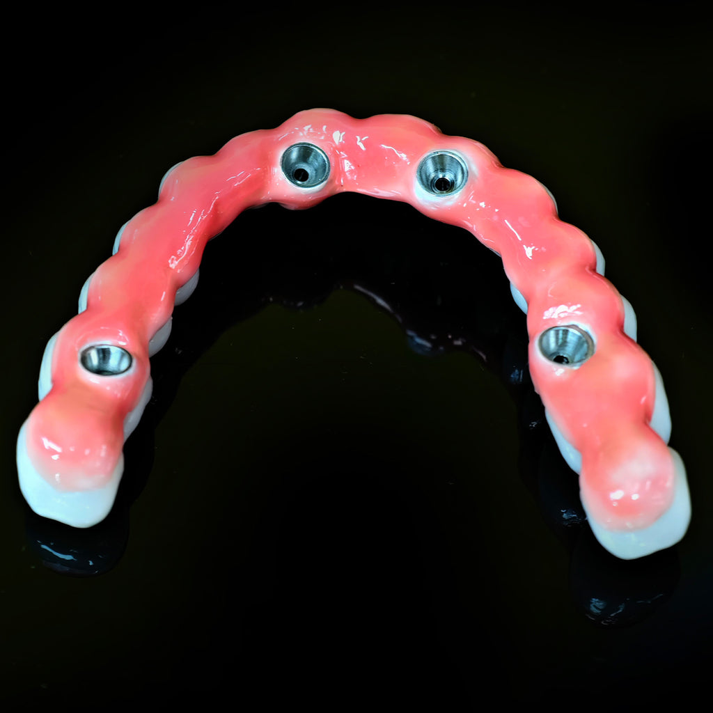 Zirconia-Enamel Hybrid Malo Bridge