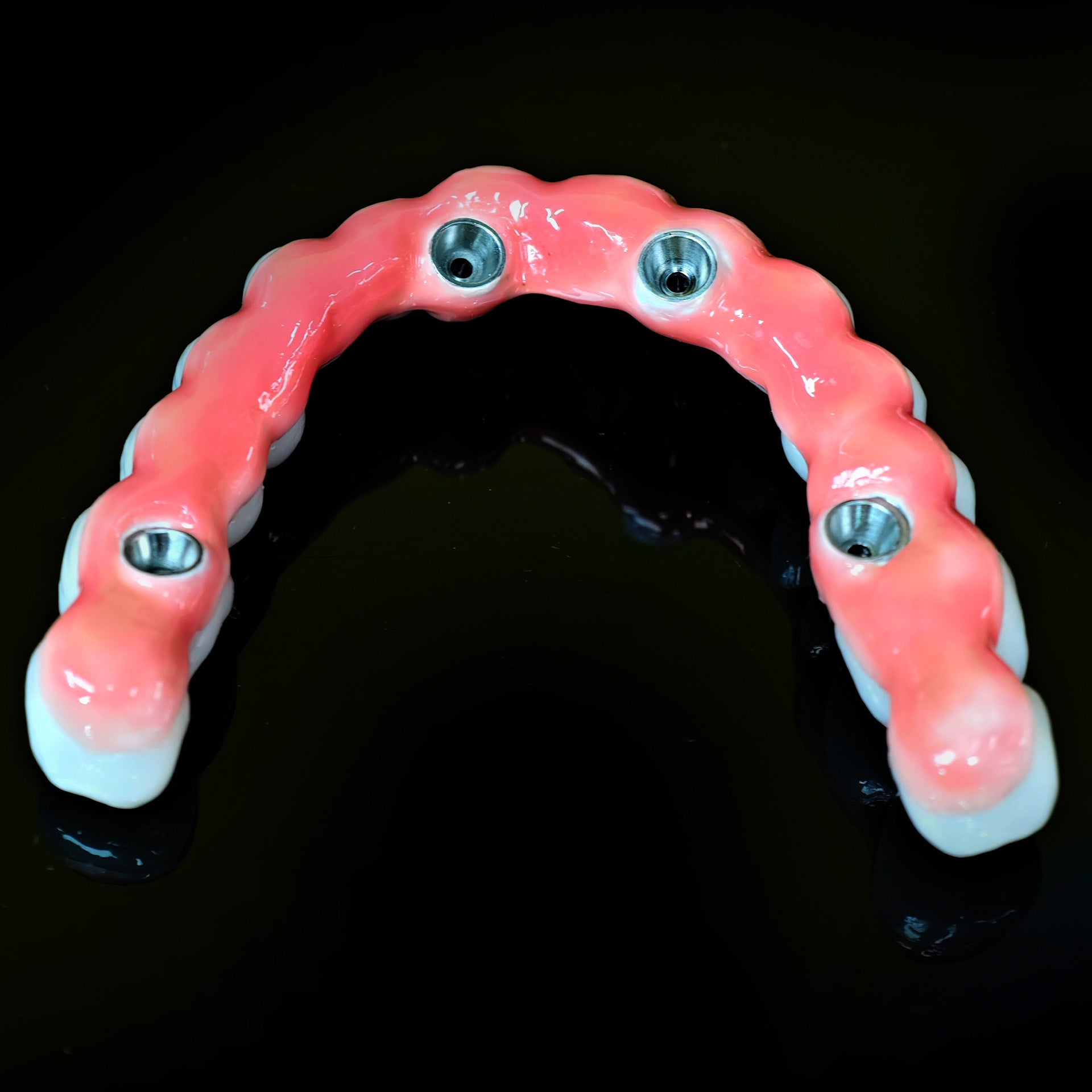Zirconia-Enamel Hybrid Malo Bridge