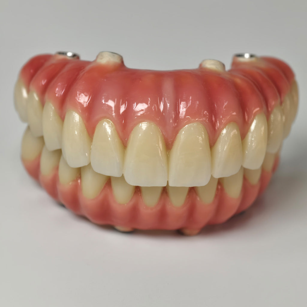 Zirconia-Enamel Hybrid Malo Bridge