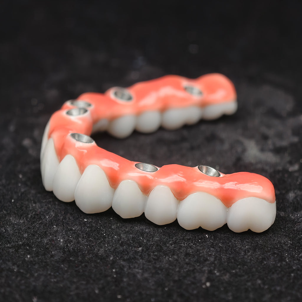 Zirconia-Enamel Hybrid Malo Bridge