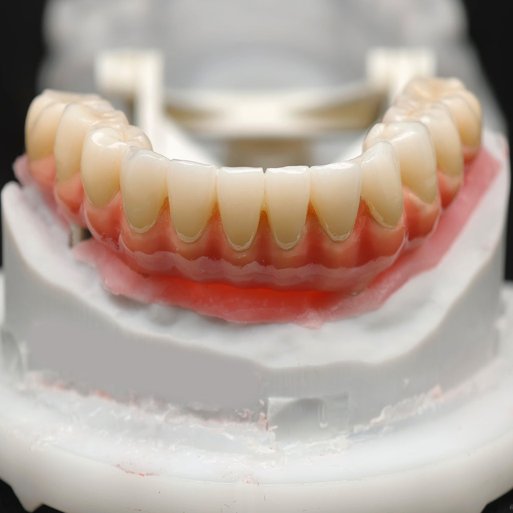 Zirconia-Enamel Hybrid Malo Bridge