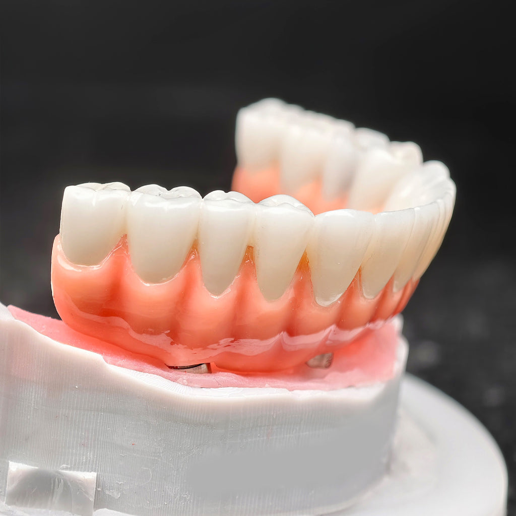 Zirconia-Enamel Hybrid Malo Bridge