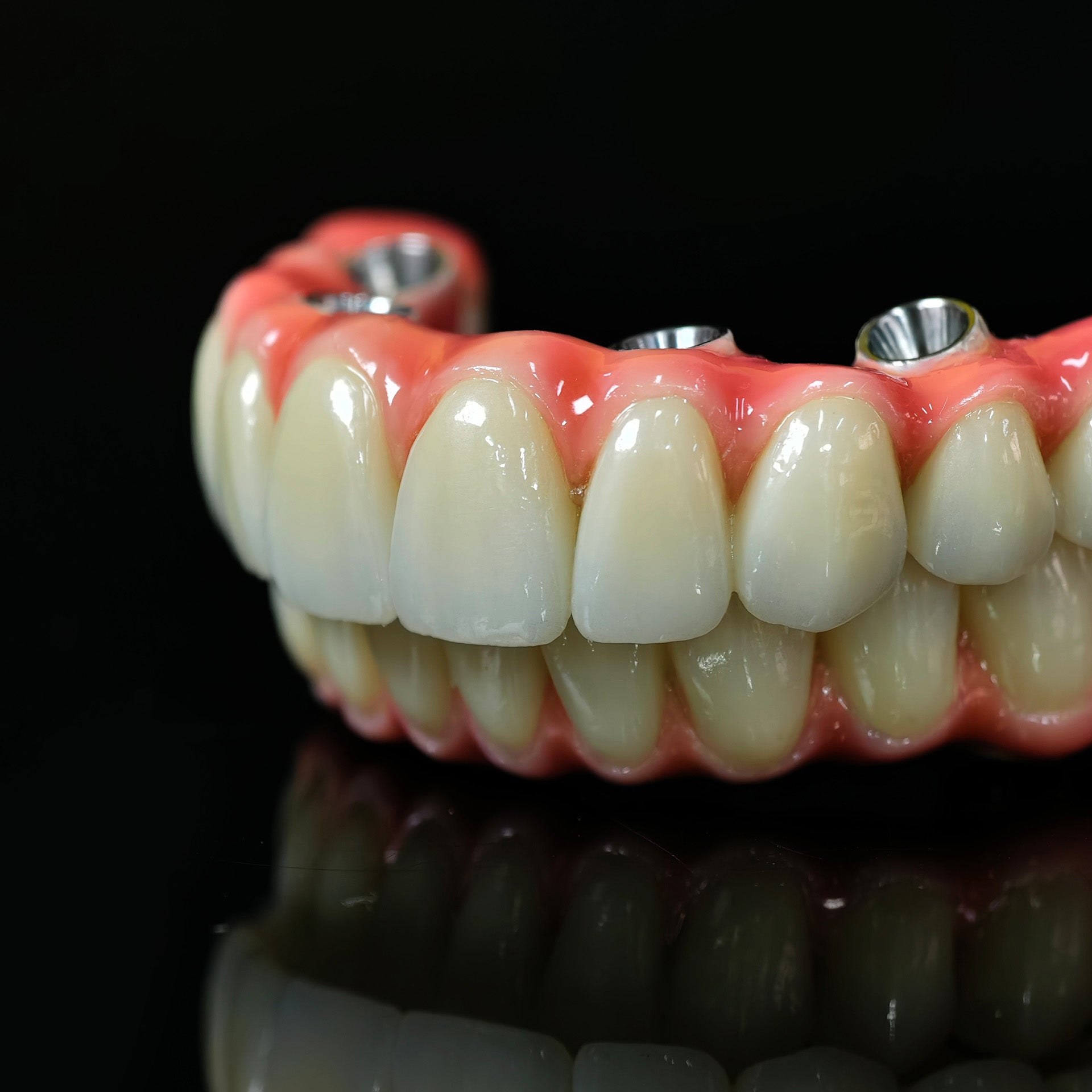 Zirconia-Enamel Hybrid Malo Bridge