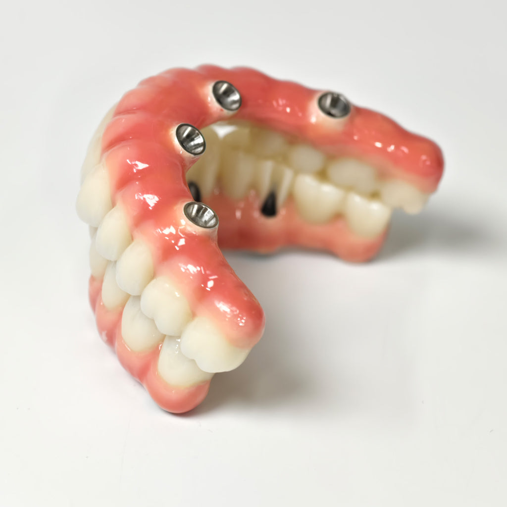 Zirconia-Enamel Hybrid Malo Bridge